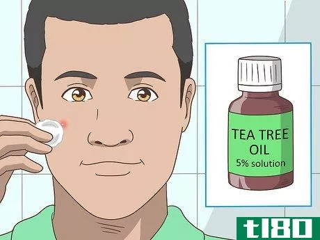Image titled Get Rid of a Pimple Step 10