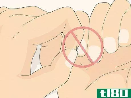 Image titled Get Rid of Hangnails Step 7