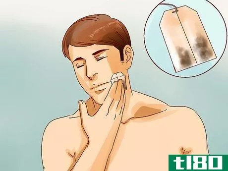 Image titled Get Rid of a Hard Pimple Step 2