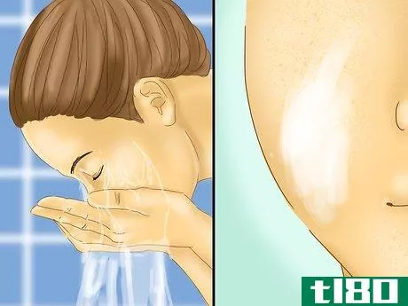 Image titled Get Rid of Rosy Cheeks Step 1