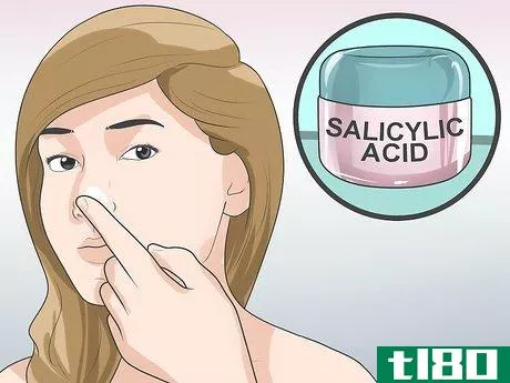 Image titled Get Rid of Acne on Your Nose Step 2