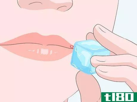 Image titled Get Rid of a Cold Sore Step 12