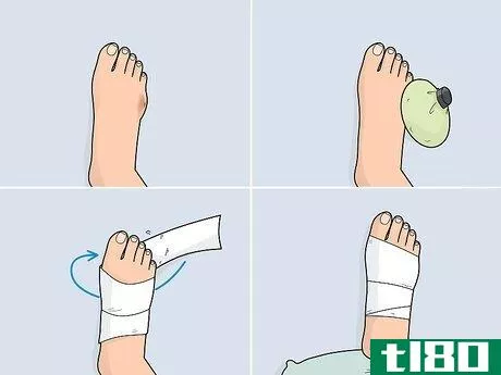 Image titled Heal a Toe Injury Step 6
