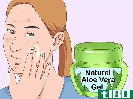 Image titled Get Rid of Acne Fast Step 11