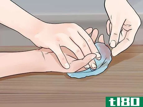 Image titled Give First Aid for a Severed Finger Step 8