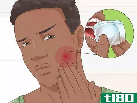 Image titled Know if Your Dental Fillings Need Replacing Step 1
