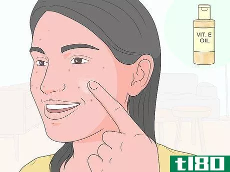 Image titled Get Rid of Acne Scars at Home Without Chemicals Step 3