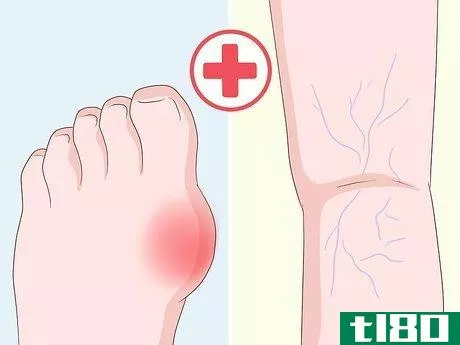 Image titled Get Rid of Leg Pain Step 14