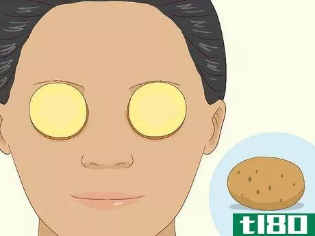 Image titled Get Rid of Puffy Eyelids Step 4