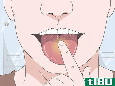 如何吃了酸糖后治好你的舌头(heal your tongue after eating sour candy)