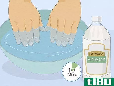 Image titled Get Rid of White Spots on Your Nails Step 3