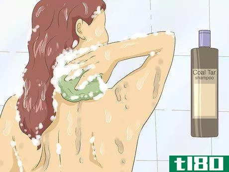 Image titled Get Rid of Psoriasis Step 3