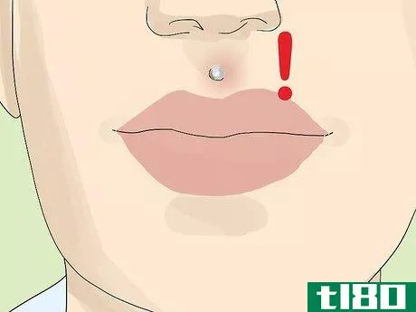 Image titled Get a Medusa Piercing Step 18