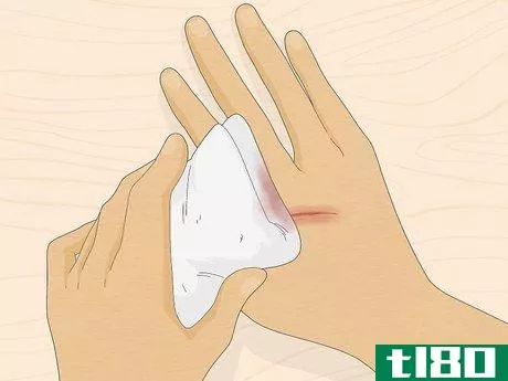 Image titled Improvise a Small Bandage Step 4