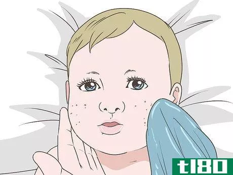 Image titled Get Rid of Baby Acne Step 2
