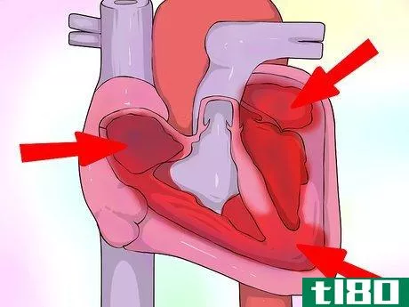 Image titled Interpret Echocardiograms Step 5