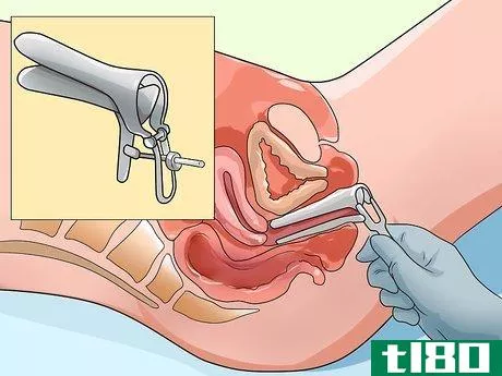 Image titled Have a Gynecological Exam Step 18