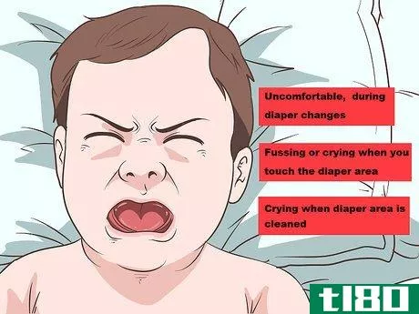 Image titled Identify and Treat Different Types of Diaper Rash Step 2