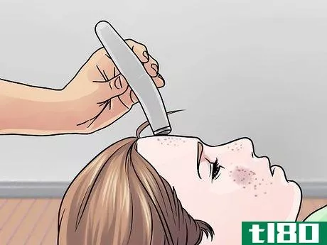 Image titled Get Rid of Cystic Acne Scars Step 8