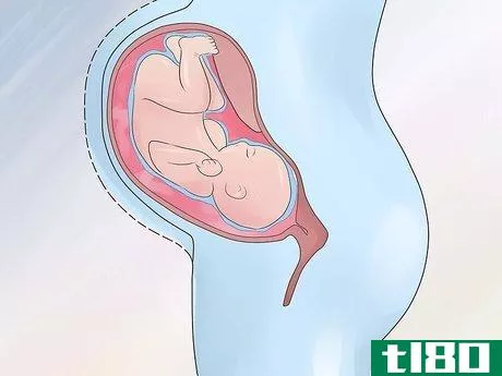 Image titled Increase Amniotic Fluid Step 14