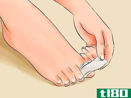Image titled Remove an Ingrown Toenail Step 17