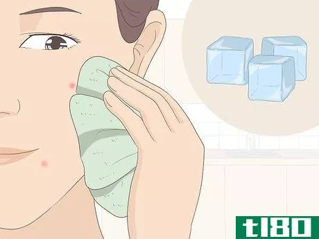 Image titled Get Rid of Acne Redness Fast Step 1