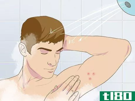 Image titled Get Rid of a Zit on Your Armpit Step 1