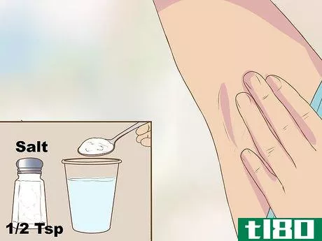 Image titled Get Rid of a Zit on Your Armpit Step 4