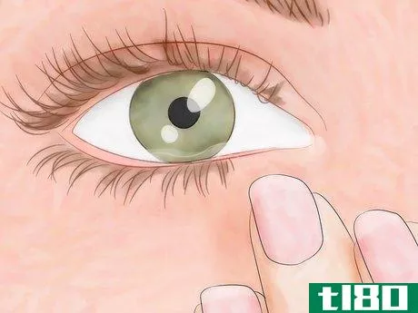 Image titled Know if You Have Eye Mites Step 1
