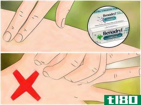Image titled Identify Insect Bites Step 10