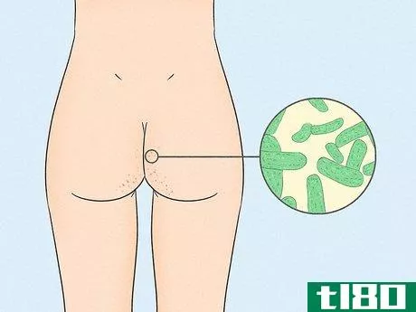 Image titled Get Rid of Acne on the Buttocks Step 1