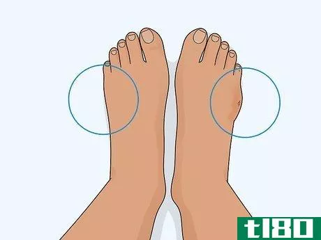 Image titled Heal a Toe Injury Step 4