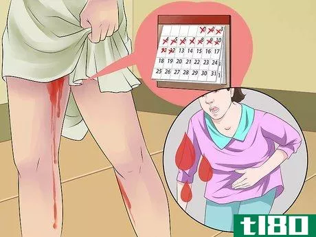 Image titled Identify Signs of Secondary Dysmenorrhea Step 5