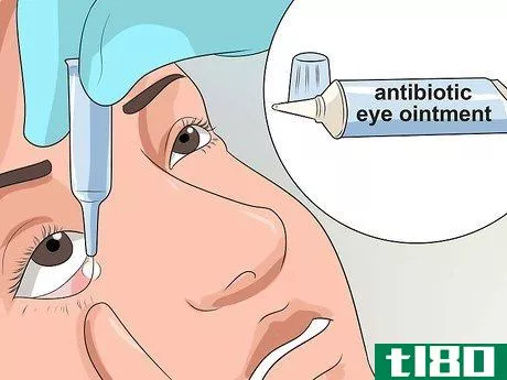 Image titled Get Rid of Pink Eye Fast Step 10