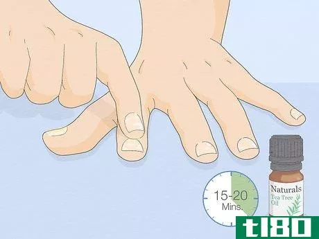 Image titled Get Rid of White Spots on Your Nails Step 2