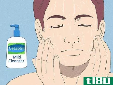 Image titled Get Rid of Acne if You Have Fair Skin Step 14