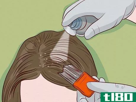 Image titled Get Rid of Lice Step 10