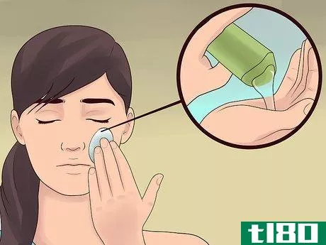 Image titled Treat Cystic Acne Step 16