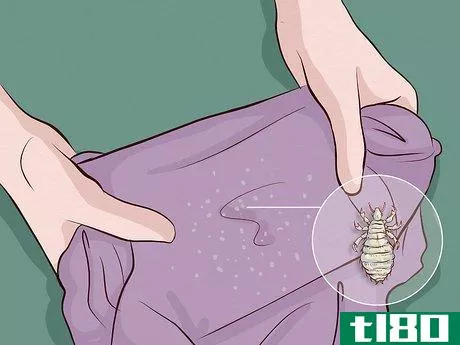Image titled Get Rid of Lice Step 2