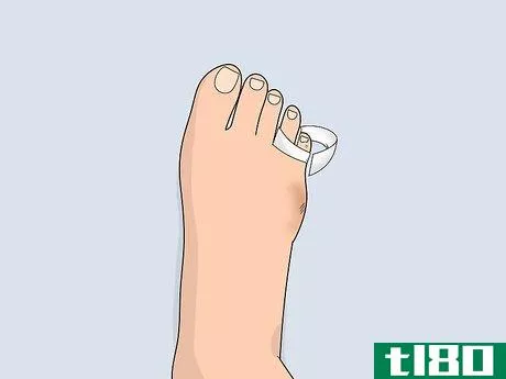 Image titled Heal a Toe Injury Step 10
