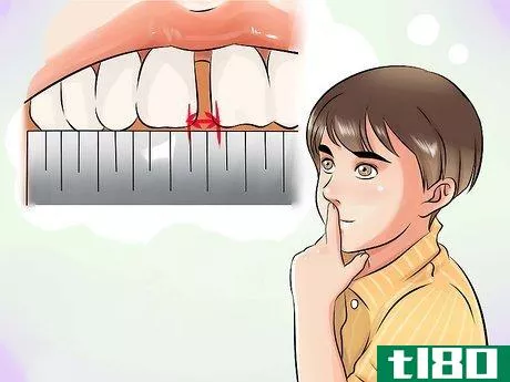 Image titled Get Rid of Gaps in Teeth Step 5