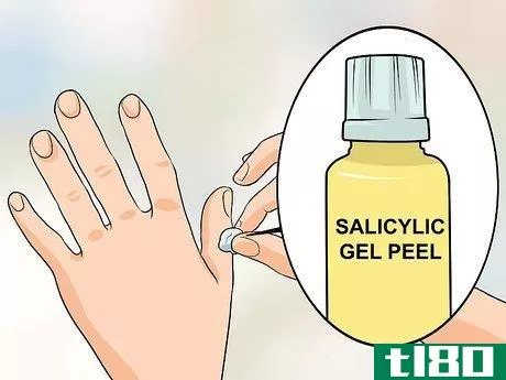 Image titled Get Rid of Warts on Fingers Step 1