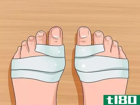 Image titled Get Rid of Bunions Step 6