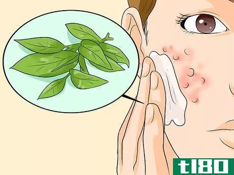 Image titled Use Herbal Remedies for Rosacea Step 6