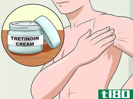 Image titled Get Rid of Stretch Marks Fast Step 10