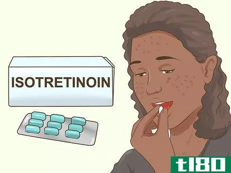 Image titled Know if You Need a Prescription Acne Treatment Step 11