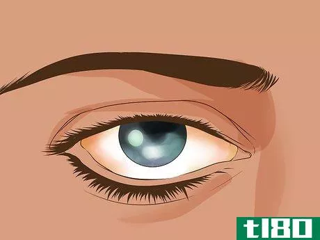 Image titled Know if You Are Ready for Contact Lenses Step 4