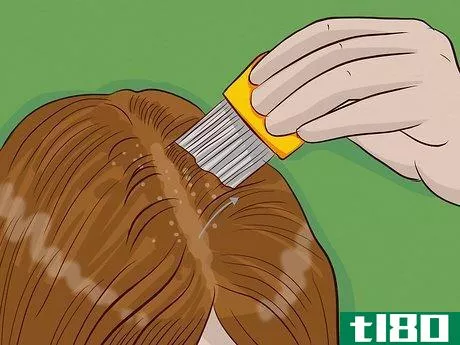 Image titled Get Rid of Lice Step 7