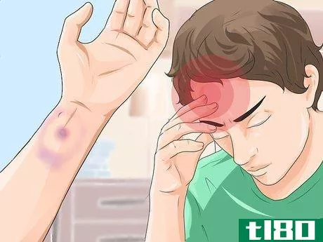 Image titled Know if a Pet Bite Is Serious Step 5