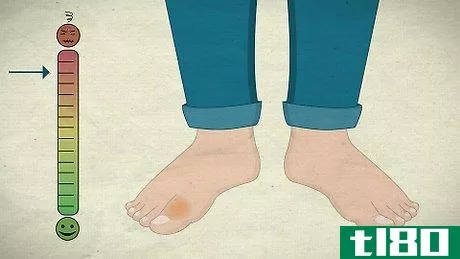 Image titled Know if Your Toe Is Broken Step 1